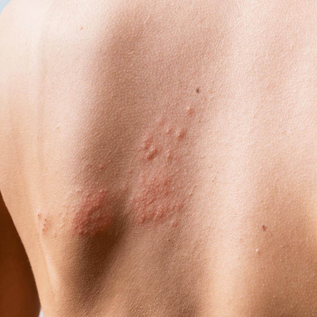 Itchy, Bumpy, Cracked Skin? - Shea Your Way