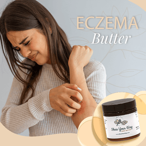 Eczema Butter - Shea Your Way